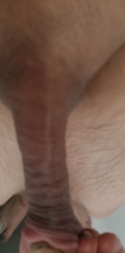 10125 bm.:? Sicht: verbund Narbe